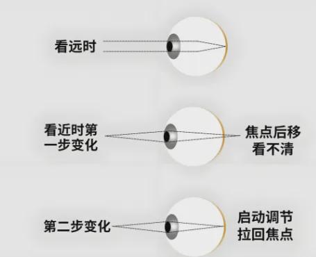 多参加户外活动远离近视(图3)